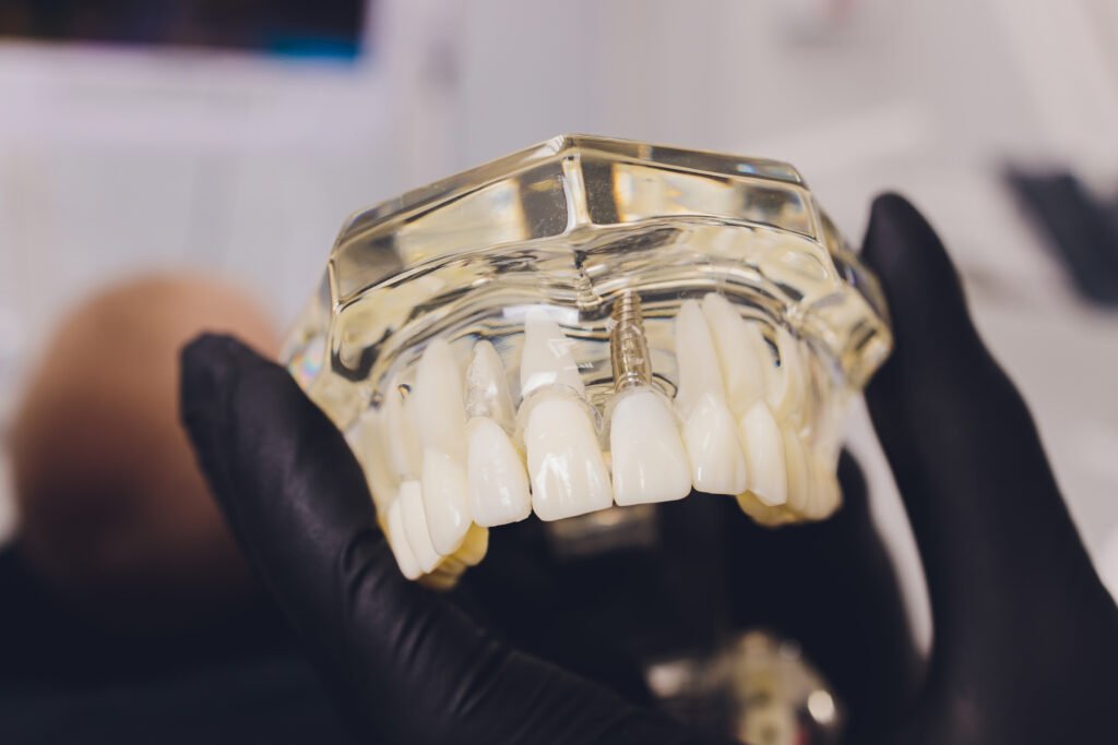 orthodontist holds jaw in his hands for training. package with capillaries, roots, pins. orthodontist holds jaw in his hands for training. package with capillaries, roots, pins.