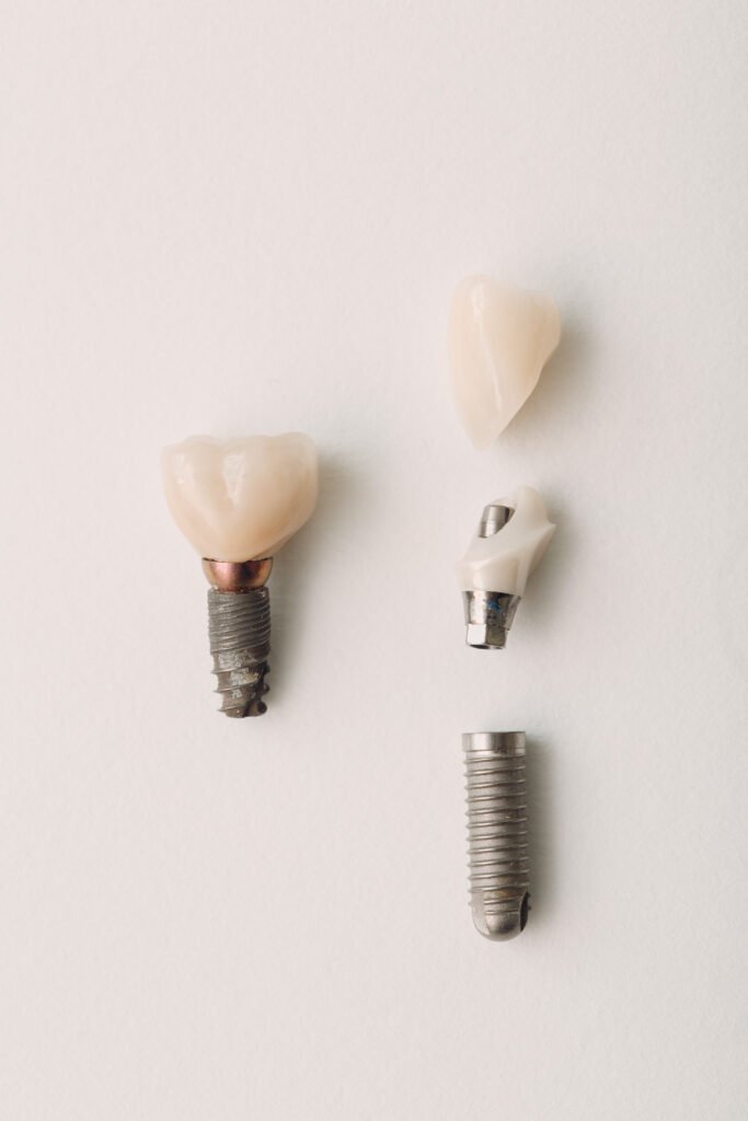 dental implant of a human tooth and its parts on a white background dental implant of a human tooth and its parts on a white background